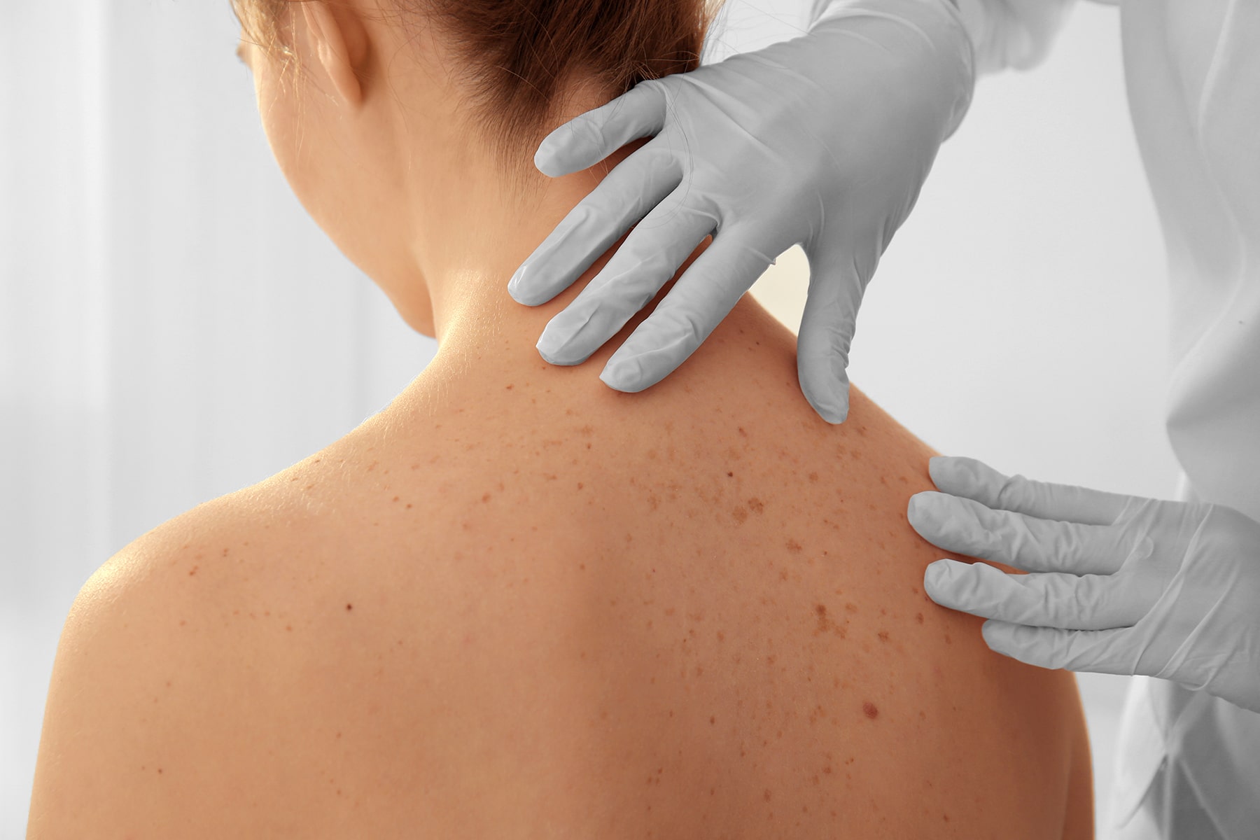 MySkinInstituteMedical2-min Medical dermatology services in Turlock, CA