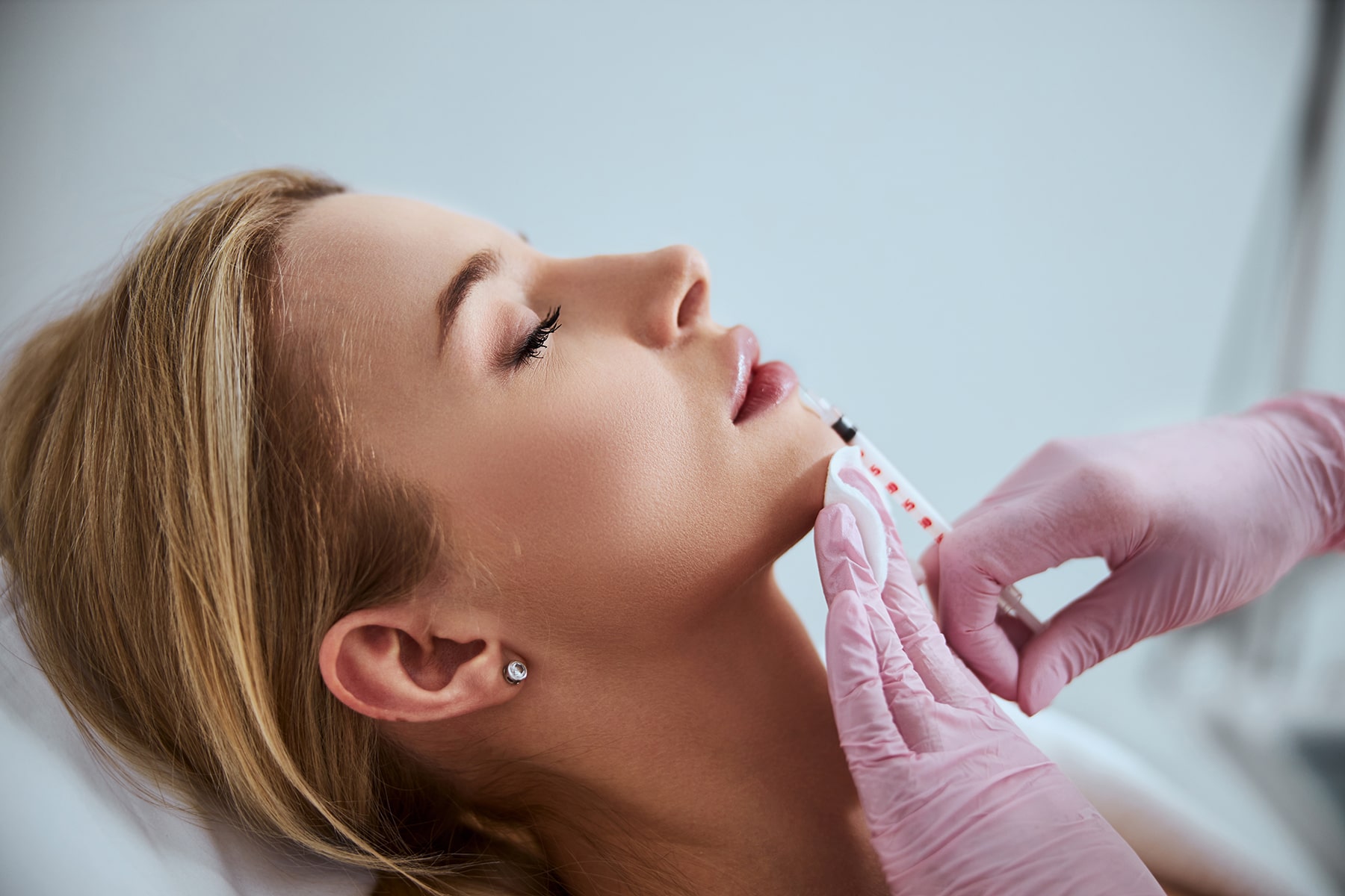 Dermal Fillers in Turlock, CA