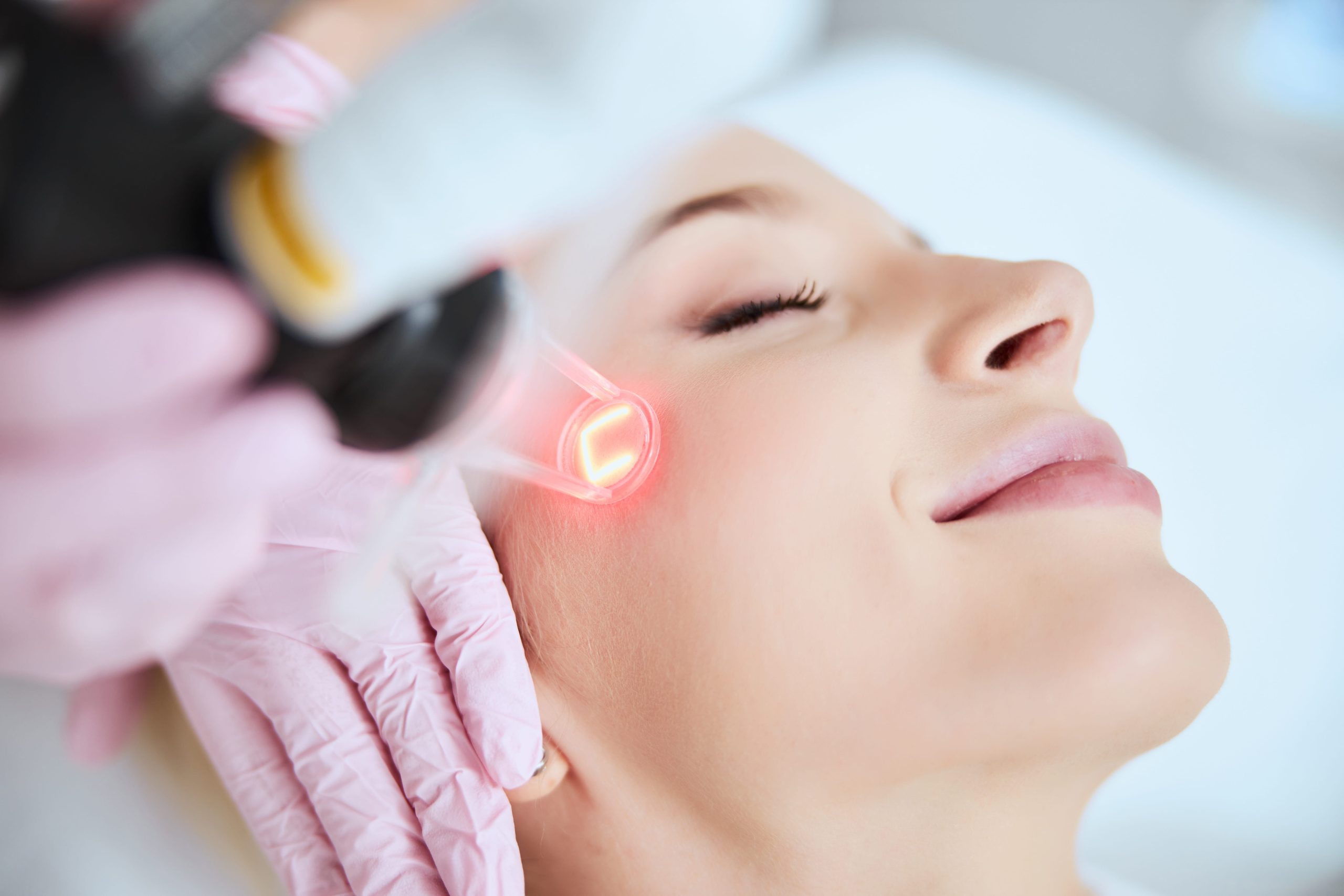 Erbium laser skin resurfacing in Turlock, CA