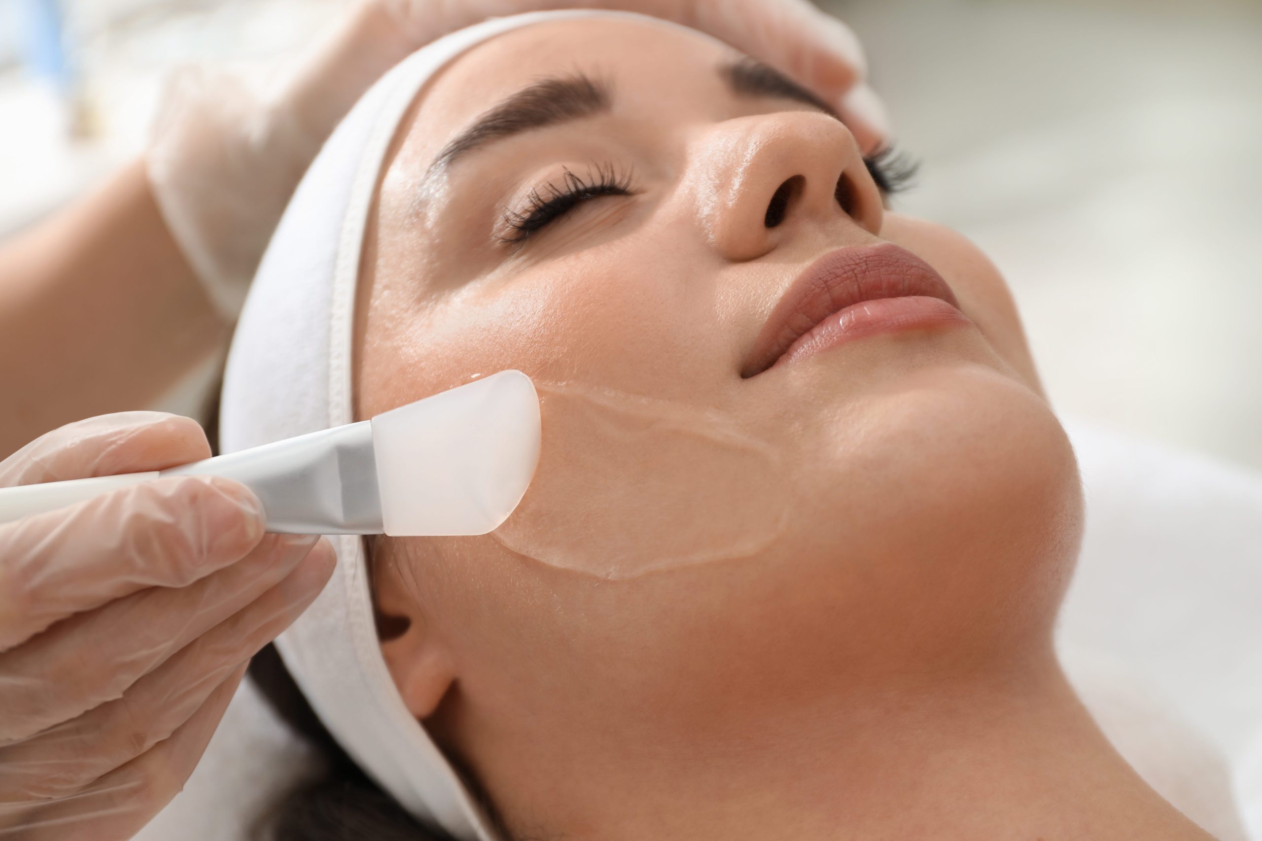 Skin chemical peel in Turlock, CA