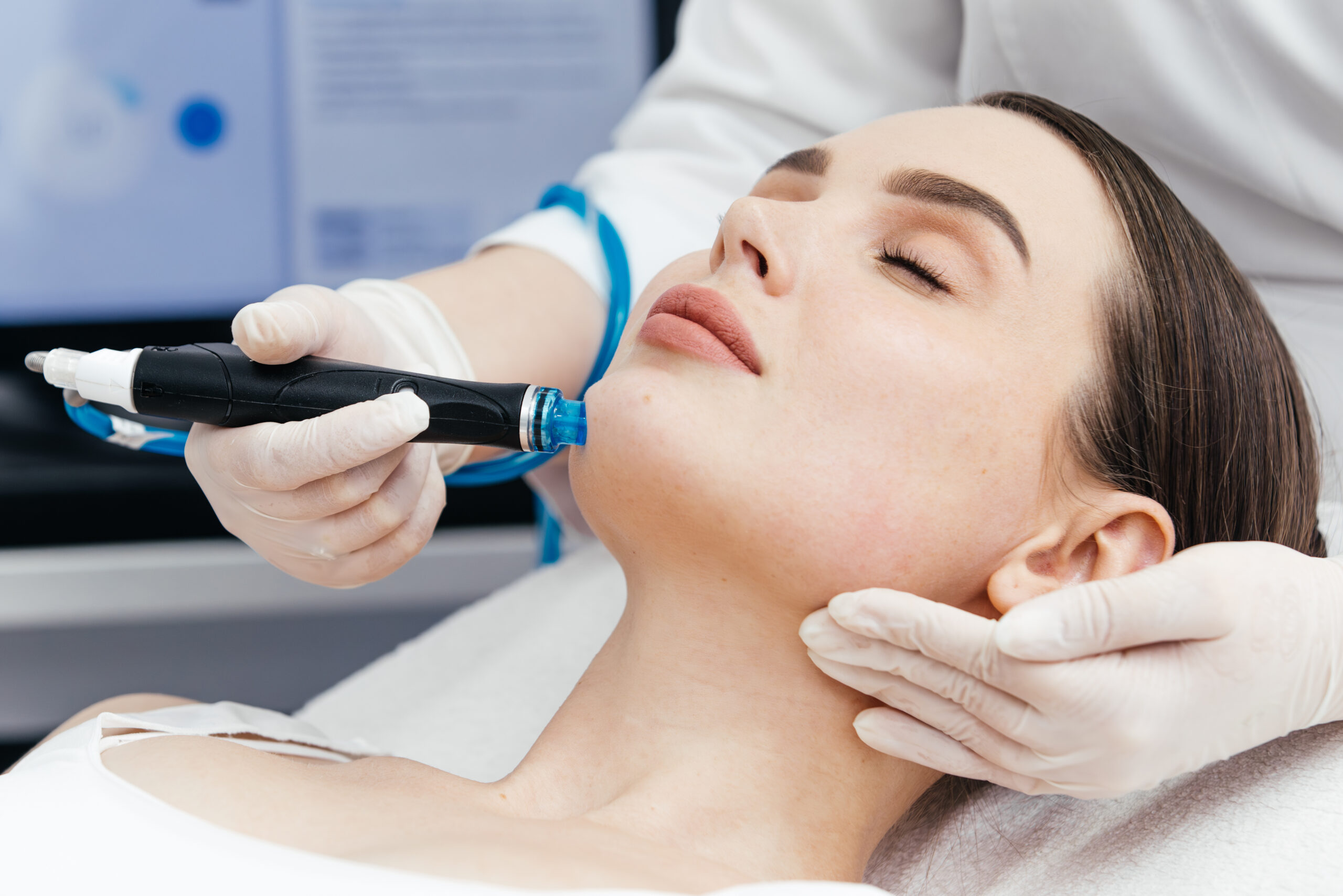 SilkPeel Dermalinfusion in Turlock, CA